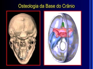 Osteologia da Base do Crânio
 