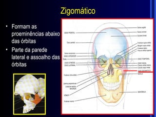 Zigomático
• Formam as
  proeminências abaixo
  das órbitas
• Parte da parede
  lateral e assoalho das
  órbitas
 