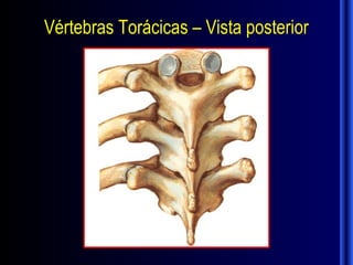Vértebras Torácicas – Vista posterior
 