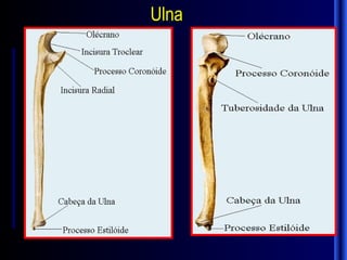 Ulna
 