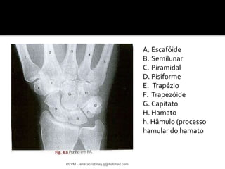 RCVM - renatacristina9.9@hotmail.com 
A. Escafóide 
B. Semilunar 
C. Piramidal 
D. Pisiforme 
E. Trapézio 
F. Trapezóide 
G. Capitato 
H. Hamato 
h. Hâmulo (processo 
hamular do hamato 
 