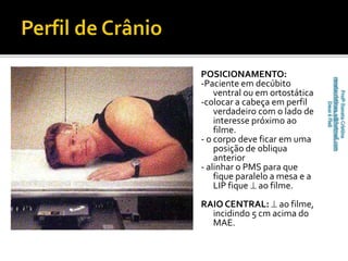 POSICIONAMENTO: 
-Paciente em decúbito 
ventral ou em ortostática 
-colocar a cabeça em perfil 
verdadeiro com o lado de 
interesse próximo ao 
filme. 
- o corpo deve ficar em uma 
posição de obliqua 
anterior 
- alinhar o PMS para que 
fique paralelo a mesa e a 
LIP fique  ao filme. 
RAIO CENTRAL:  ao filme, 
incidindo 5 cm acima do 
MAE. 
 