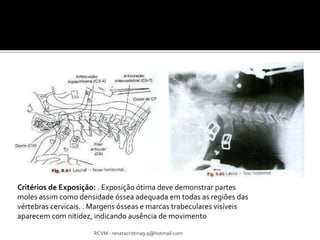 Critérios de Exposição: . Exposição ótima deve demonstrar partes 
moles assim como densidade óssea adequada em todas as regiões das 
vértebras cervicais. . Margens ósseas e marcas trabeculares visíveis 
aparecem com nitidez, indicando ausência de movimento 
RCVM - renatacristina9.9@hotmail.com 
 