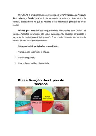O PUCLAS é um programa desenvolvido pelo EPUAP (European Pressure
Ulcer Advisory Panel), para servir de ferramenta de estudo ao tema úlcera de
pressão, especialmente no que diz respeito à sua classificação pelo grau de lesão
tissular.
Lesões por umidade são frequentemente confundidas com úlceras de
pressão. As lesões por umidade são lesões cutâneas e não causadas por pressão e
ou forças de deslizamento (cisalhamento). É importante distinguir uma úlcera de
pressão de uma lesão por incontinência.
São características de lesões por umidade:
Vários pontos superficiais e difusos;
Bordos irregulares;
Pele brilhosa, úmida e hiperemiada.
Classificação dos tipos de
tecidos
 