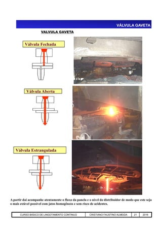 VÁLVULA GAVETA
VALVULA GAVETA
Válvula Aberta
Válvula Fechada
Aciaria GGRJ-ACI-LC-020 Preparação do Distribuidor para Partida ‹nº› 17/05/03
Válvula Estrangulada
A partir daí acompanhe atentamente o fluxo da panela e o nível do distribuidor de modo que este seja
o mais estável possível com jatos homogêneos e sem risco de acidentes.
CURSO BÁSICO DE LINGOTAMENTO CONTINUO CRISTIANO FAUSTINO ALMEIDA 21 2016
 
