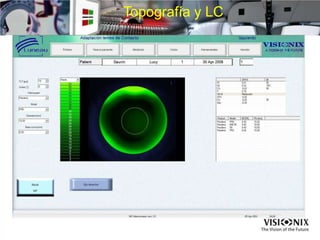 Topografía y LC
 