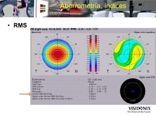 Aberrometría, índices
• RMS
 