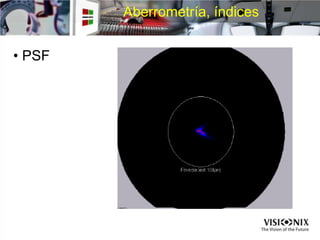 Aberrometría, índices
• PSF
 