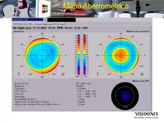 Mapa Aberrométrico
 