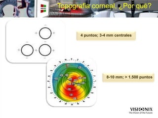 Topografia corneal, ¿Por qué?
4 puntos; 3-4 mm centrales
8-10 mm; > 1.500 puntos
 