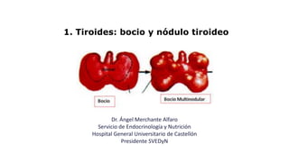 1. Tiroides: bocio y nódulo tiroideo
Dr. Ángel Merchante Alfaro
Servicio de Endocrinología y Nutrición
Hospital General Universitario de Castellón
Presidente SVEDyN
 