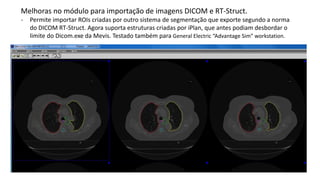 Melhoras no módulo para importação de imagens DICOM e RT-Struct.
- Permite importar ROIs criadas por outro sistema de segmentação que exporte segundo a norma
do DICOM RT-Struct. Agora suporta estruturas criadas por iPlan, que antes podiam desbordar o
limite do Dicom.exe da Mevis. Testado também para General Electric “Advantage Sim” workstation.
 