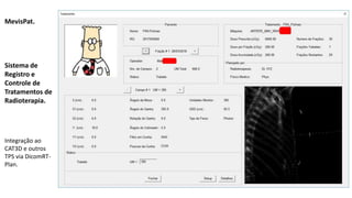 MevisPat.
Sistema de
Registro e
Controle de
Tratamentos de
Radioterapia.
Integração ao
CAT3D e outros
TPS via DicomRT-
Plan.
 