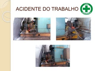 ACIDENTE DO TRABALHO
 