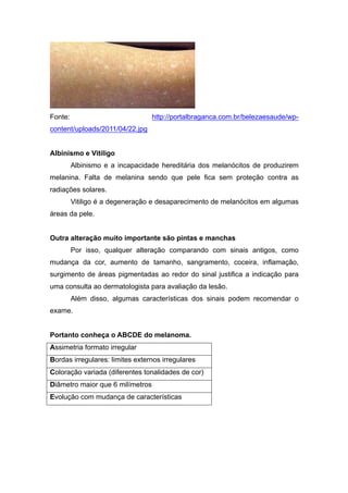 Fonte: http://portalbraganca.com.br/belezaesaude/wp-
content/uploads/2011/04/22.jpg
Albinismo e Vitiligo
Albinismo e a incapacidade hereditária dos melanócitos de produzirem
melanina. Falta de melanina sendo que pele fica sem proteção contra as
radiações solares.
Vitiligo é a degeneração e desaparecimento de melanócitos em algumas
áreas da pele.
Outra alteração muito importante são pintas e manchas
Por isso, qualquer alteração comparando com sinais antigos, como
mudança da cor, aumento de tamanho, sangramento, coceira, inflamação,
surgimento de áreas pigmentadas ao redor do sinal justifica a indicação para
uma consulta ao dermatologista para avaliação da lesão.
Além disso, algumas características dos sinais podem recomendar o
exame.
Portanto conheça o ABCDE do melanoma.
Assimetria formato irregular
Bordas irregulares: limites externos irregulares
Coloração variada (diferentes tonalidades de cor)
Diâmetro maior que 6 milímetros
Evolução com mudança de características
 