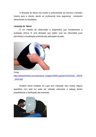 A lâmpada de Wood nos mostra a profundidade da mancha e também
mostra para a cliente, dando ao profissional mais segurança mostrando
claramentes os resultados.
Lâmpada de Wood
É um método de observação e diagnóstico que complementa a
avaliação clínica. É uma lâmpada que obtém uma luz ultravioleta pura
permitindo a visualização profunda das alterações da pele.
Fonte:
http://www.prevtech.com.br/product_images/v/934/Lupanam%C3%A3o__45318
_zoom.jpg
Existem vários modelos de Lupa com Lâmpada ultra violeta. Alguns
aparelhos com esta luz pode ser utilizado colocando a cabeça dentro
possibilitando a verificação das manchas.
 
