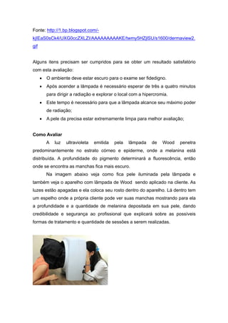 Fonte: http://1.bp.blogspot.com/-
kjIEaS0sCk4/UXG0ccZXLZI/AAAAAAAAAKE/twmy5HZjlSU/s1600/dermaview2.
gif
Alguns itens precisam ser cumpridos para se obter um resultado satisfatório
com esta avaliação:
• O ambiente deve estar escuro para o exame ser fidedigno.
• Após acender a lâmpada é necessário esperar de três a quatro minutos
para dirigir a radiação e explorar o local com a hipercromia.
• Este tempo é necessário para que a lâmpada alcance seu máximo poder
de radiação;
• A pele da precisa estar extremamente limpa para melhor avaliação;
Como Avaliar
A luz ultravioleta emitida pela lâmpada de Wood penetra
predominantemente no estrato córneo e epiderme, onde a melanina está
distribuída. A profundidade do pigmento determinará a fluorescência, então
onde se encontra as manchas fica mais escuro.
Na imagem abaixo veja como fica pele iluminada pela lâmpada e
também veja o aparelho com lâmpada de Wood sendo aplicado na cliente. As
luzes estão apagadas e ela coloca seu rosto dentro do aparelho. Lá dentro tem
um espelho onde a própria cliente pode ver suas manchas mostrando para ela
a profundidade e a quantidade de melanina depositada em sua pele, dando
credibilidade e segurança ao profissional que explicará sobre as possíveis
formas de tratamento e quantidade de sessões a serem realizadas.
 