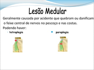 Geralmente causada por acidente que quebram ou danificam
o feixe central de nervos no pescoço e nas costas.
Podendo haver:
  • tetraplegia                 paraplegia
 