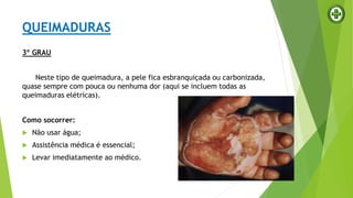 3º GRAU
Neste tipo de queimadura, a pele fica esbranquiçada ou carbonizada,
quase sempre com pouca ou nenhuma dor (aqui se incluem todas as
queimaduras elétricas).
Como socorrer:
 Não usar água;
 Assistência médica é essencial;
 Levar imediatamente ao médico.
QUEIMADURAS
 