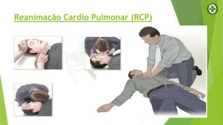 Reanimação Cardio Pulmonar (RCP)
 