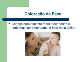 Coloração da Face
 Criança com aspecto febril: bochechas e
nariz mais avermelhados, e face mais pálida.
 