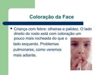 Coloração da Face
 Criança com febre: olheiras e palidez. O lado
direito do rosto está com coloração um
pouco mais rocheada do que o
lado esquerdo. Problemas
pulmonares, como veremos
mais adiante.
 