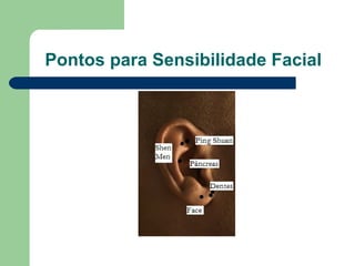 Pontos para Sensibilidade Facial
 