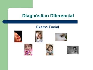 Diagnóstico Diferencial
Exame Facial
 