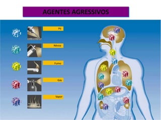 Pó
Névoa
Fumo
Gás
Vapor
AGENTES AGRESSIVOS
 