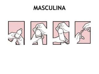 MASCULINA
 
