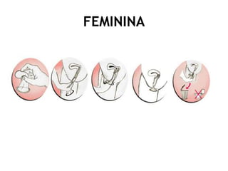 FEMININA
 