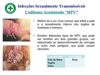 Infecções Sexualmente Transmissíveis
Codiloma Acuminado “HPV”
• Refere se a um vírus comum que afeta a pele
e o revestimento interno dos órgãos de
mulheres e homens.
• Existem diferentes tipos de HPV, que pode
ser dividido em dois grandes grupos, um
relacionado ao desenvolvimento de verrugas
e outro mais perigoso, que pode causar
cânceres.
NA MULHER NO HOMEM
Colo do Útero
Vagina
Vulva
Ânus
 