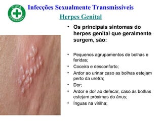 Infecções Sexualmente Transmissíveis
Herpes Genital
• Os principais sintomas do
herpes genital que geralmente
surgem, são:
• Pequenos agrupamentos de bolhas e
feridas;
• Coceira e desconforto;
• Ardor ao urinar caso as bolhas estejam
perto da uretra;
• Dor;
• Ardor e dor ao defecar, caso as bolhas
estejam próximas do ânus;
• Ínguas na virilha;
 