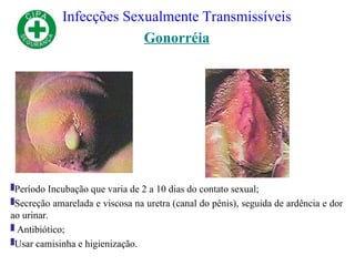Infecções Sexualmente Transmissíveis
Gonorréia
Período Incubação que varia de 2 a 10 dias do contato sexual;
Secreção amarelada e viscosa na uretra (canal do pênis), seguida de ardência e dor
ao urinar.
 Antibiótico;
Usar camisinha e higienização.
 