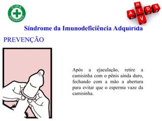 Síndrome da Imunodeficiência Adquirida
PREVENÇÃO
Após a ejaculação, retire a
camisinha com o pênis ainda duro,
fechando com a mão a abertura
para evitar que o esperma vaze da
camisinha.
 
