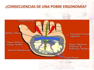 ¿CONSECUENCIAS DE UNA POBRE ERGONOMÍA?
 