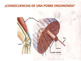 ¿CONSECUENCIAS DE UNA POBRE ERGONOMÍA?
 