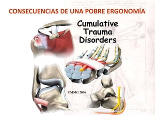 CONSECUENCIAS DE UNA POBRE ERGONOMÍA
 