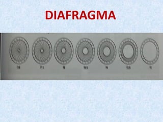 DIAFRAGMA
 