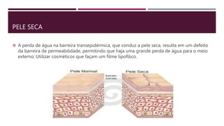 PELE SECA
 A perda de água na barreira transepidérmica, que conduz a pele seca, resulta em um defeito
da barreira de permeabilidade, permitindo que haja uma grande perda de água para o meio
externo; Utilizar cosméticos que façam um filme lipofílico.
 
