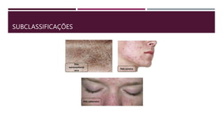 SUBCLASSIFICAÇÕES
 