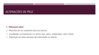ALTERAÇÕES DE PELE
 Melanose solar:
 Manchas de cor castanho claro ou escuro;
 Localizada normalmente no dorso das mãos, antebraços, colo e face;
 Exposição ao solar, pessoas de meia idade ou idosos.
 