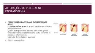 ALTERAÇÕES DE PELE – ACNE
ETIOPATOGENIA
 PROLIFERAÇÃO BACTERIANA CUTIBACTERIUM
ACNES
O cutibacterium acnes (P. acnes), bactéria que plorifera
no ducto folicular.
Quebra os triglicerídeos do sebo e os ácidos graxos
livres vão irritar a parede folicular e acaba causando os
processos inflamatórios;
Liberação de mediadores químicos.
 Fatores Imunológicos
 