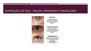 ALTERAÇÕES DE PELE – MILIUM, SIRINGOMA E XANTELASMA
 