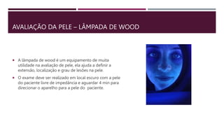 AVALIAÇÃO DA PELE – LÂMPADA DE WOOD
 A lâmpada de wood é um equipamento de muita
utilidade na avaliação de pele, ela ajuda a definir a
extensão, localização e grau de lesões na pele.
 O exame deve ser realizado em local escuro com a pele
do paciente livre de impedância e aguardar 4 min para
direcionar o aparelho para a pele do paciente.
 