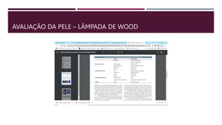 AVALIAÇÃO DA PELE – LÂMPADA DE WOOD
 