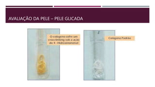 AVALIAÇÃO DA PELE – PELE GLICADA
 