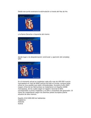 Desde ese punto avanzara la estimulación a través del Haz de His
y la Rama Derecha e Izquierda del mismo
dando lugar a la despolarización ventricular y aparición del complejo
QRS
En el momento actual se implantan cada año mas de 400.000 nuevos
marcapasos en mas de 6000 centros de todo el mundo, aunque estas
cifras es muy posible que estén infravaloradas. Durante el año 2003
(según cifras de los fabricantes) se implantaron en España 22098
marcapasos, de los cuales según el registro nacional el 80%
correspondían a primo implantes y el 20% a recambios del generador. El
índice de implantación según los distintos países Europeos podría
situarse de esta manera.
España 415/1000.000 de habitantes
Inglaterra
Holanda
Suecia
 