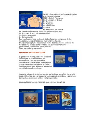 NASPE : North American Society of Pacing
and Electrophisiology
BPEG : British Pacing and
Electrophisiology Group
0= Ninguna
A= Auricular
V= Ventricular
D= Dual
R= Respuesta frecuencia
P= Programacion simple ò función antitaquicardia en V
S= Shock en V; en I y II Monocameral
M= Multiprogramable
C= Comunicación
Esta clasificación esta anticuada dado el avance vertiginoso de los
marcapasos ,precisándose una nueva nomenclatura.
En próximos capítulos hablaremos de los distintos modos y clases de
marcapasos; en este tema vamos a ver específicamente los
generadores., conexiones y circuitos así
como los cables y electrodos.
SISTEMAS DE ESTIMULACION
El generador de impulsos y los catéteres
constituyen el sistema básico de
estimulación. Con frecuencia nos
olvidamos de que tenemos una maquina
que requiere comprensión de su física y
funcionamiento para adaptarlo a nuestras
necesidades según modelos.
Los generadores de impulsos han ido variando de tamaño y forma a lo
largo del tiempo, pero el esquema básico actual consiste en , generador
de impulsos electrodos catéter y el programador.
Los circuitos se han ido haciendo cada vez más complejos
 