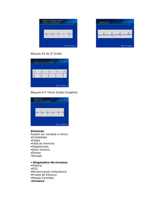 Bloqueo AV de 3º Grado
Bloqueo A-V Tercer Grado Congénito
Síntomas
Pueden ser variados e incluir:
•Irritabilidad
•Fatiga
•Falta de memoria
•Palpitaciones
•Dolor torácico
•Disnea
?Sincope
• Diagnostico No-invasivo
•Historia
•ECG
•Monitorización Ambulatoria
•Prueba de Esfuerzo
•Masaje Carotídeo
•Invasivo
 